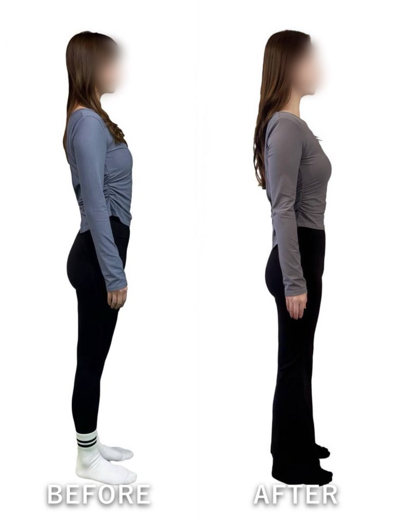 ビフォーアフター