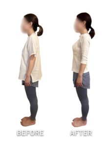 ビフォーアフター