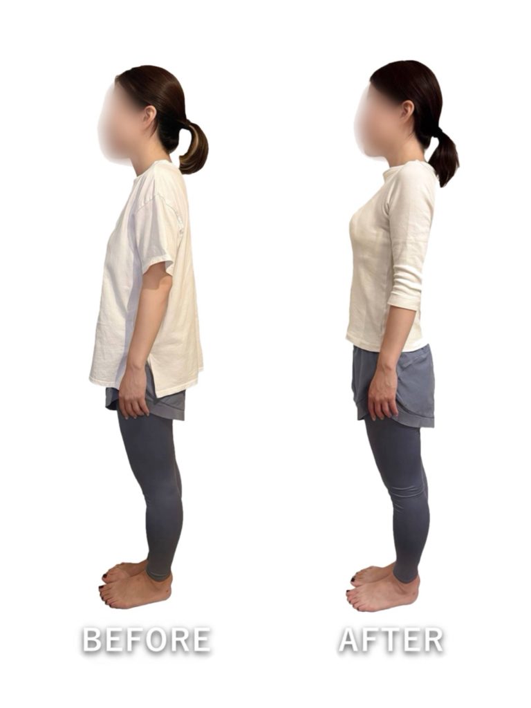 ビフォーアフター