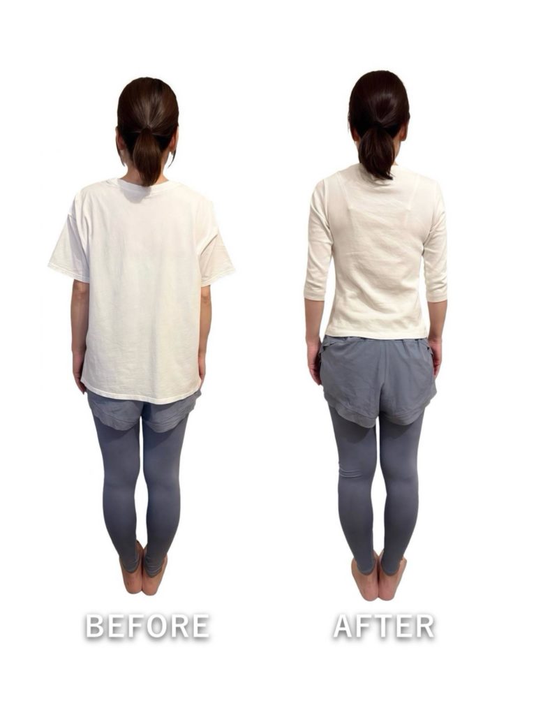 ビフォーアフター