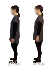 ビフォーアフター