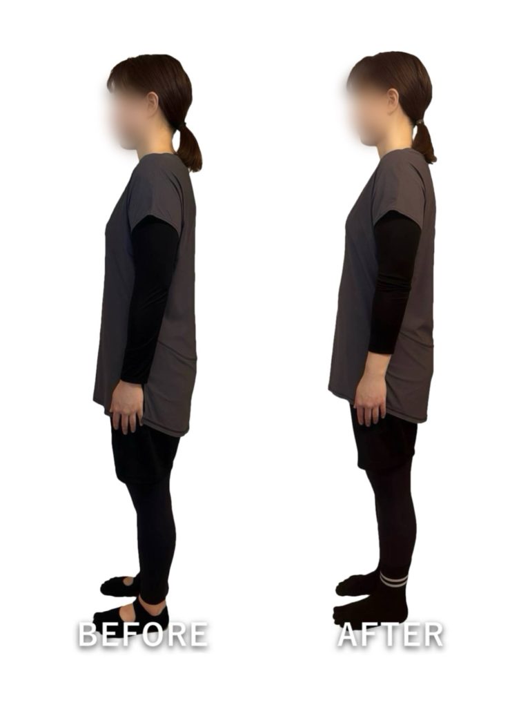 ビフォーアフター