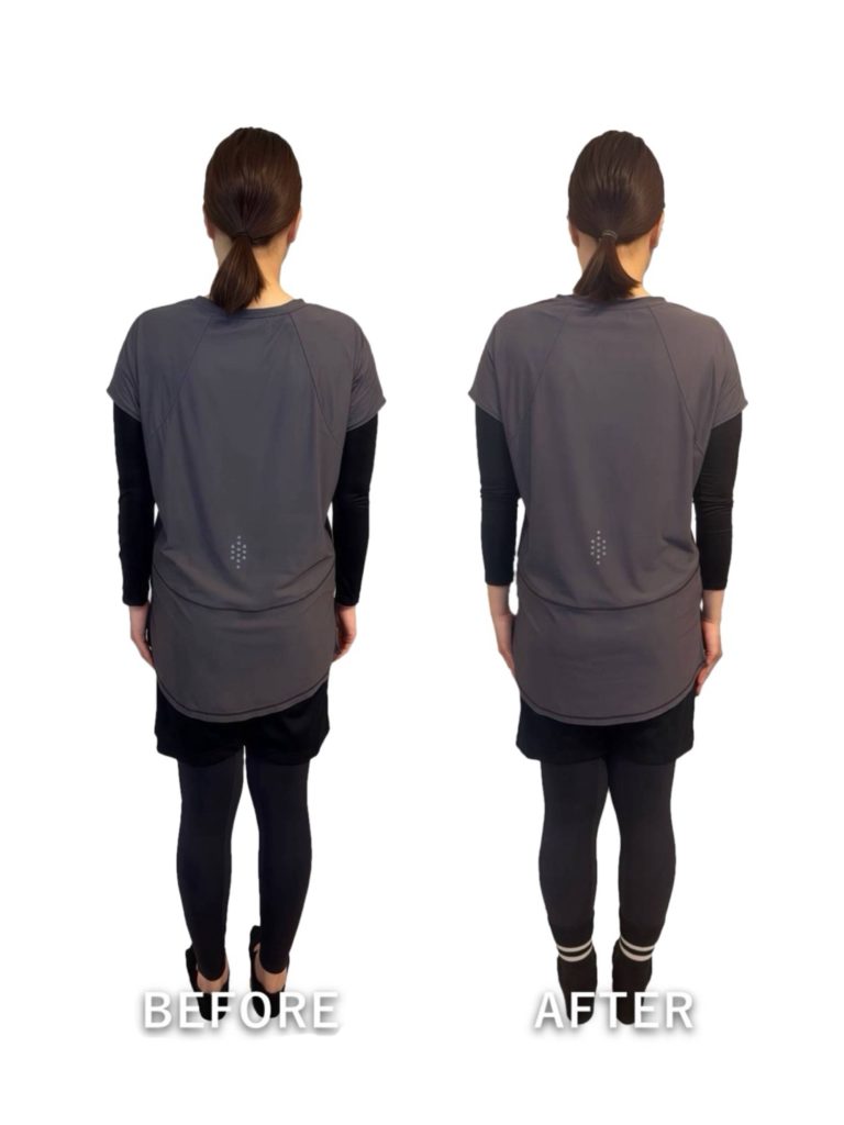 ビフォーアフター