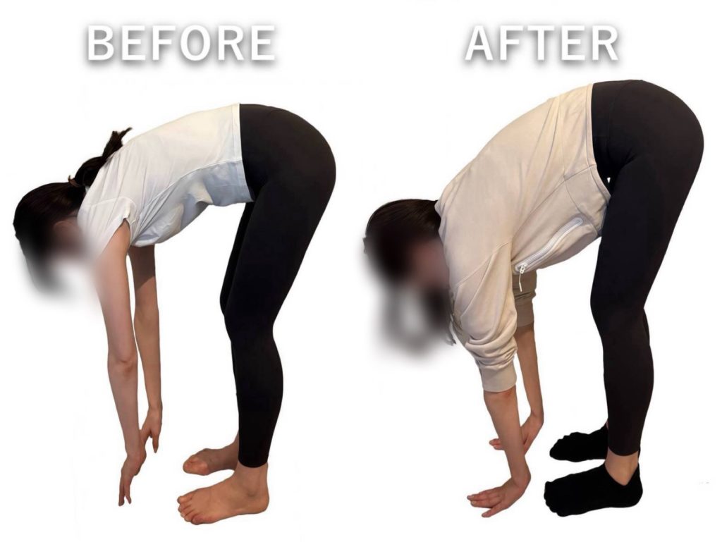 ビフォーアフター