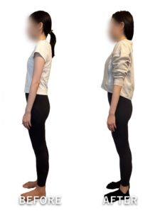 ビフォーアフター