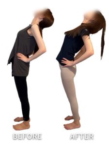 ビフォーアフター