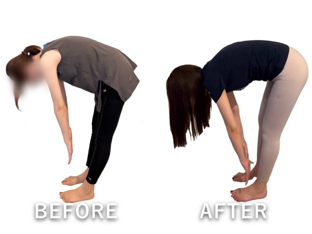 ビフォーアフター